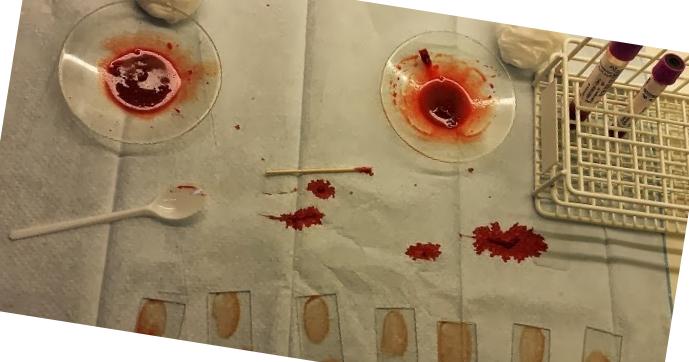 Prednisolon dela tablett