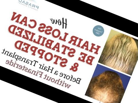 Propecia kostnad propecia kostnad